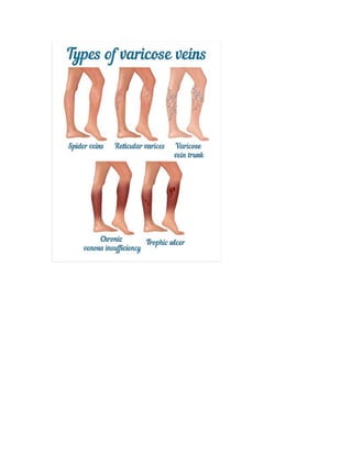Loading…
Introduction:
● Wash hands
● Introduce your self to the patient using your
full name
● Confirm you have the correct patient
● Explain what you would like to do
● Gain verbal consent
● Ensure privacy
● Ask the patient to undress from the waist
upwards
 