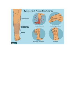 Inspection: The patient
• Do they look ill? If so; in what way?
• Weight loss
• Breathlessness
• Pursed lips breathing
• Cyanosis
• Use of accessory muscles
 