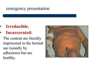 Palpation: Neck Lymph Nodes
• Examine from behind
• Check for enlargement of neck nodes groups
 