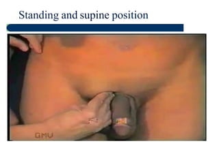 Auscultation: Breath sounds
• Vesicular:
• There is no gap between inspiration  expiration
• Inspiration is longer  louder
• Bronchial:
• There is a gap between inspiration  expiration
• Expiration is longer  louder
• Pneumonia  top of pleural effusion
 