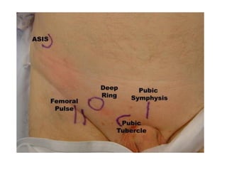 Wheezes:
• They have musical quality  usually occur in
expiration and indicate narrowing of an airway
• The smaller the airway, the higher the pitch of the
wheeze
High pitched: Asthma  COPD
Low pitched: Bronchial cancer
 