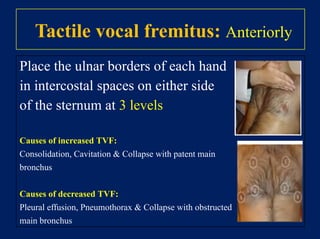 Presenting complaint
• It’s important to use open questioning to elicit the patient’s
presenting complaint
• “So what’s brought you in today?” or “Tell me about your
symptoms”
• Allow the patient time to answer
• trying not to interrupt or direct the conversation.
• Facilitate the patient to expand on their presenting complaint if
required.
• “Ok, so tell me more about that” “Can you explain what that
pain was like?”
 