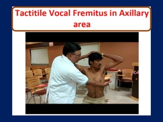 History of presenting complaint
• Questions to ask about the lump
• Onset – When did they first notice the lump?
• Size – Has it changed? / Over what duration?
• Is the lump’s size or discomfort related to the
menstrual cycle in any way?
• Is the lump painful? – ask SOCRATES
 