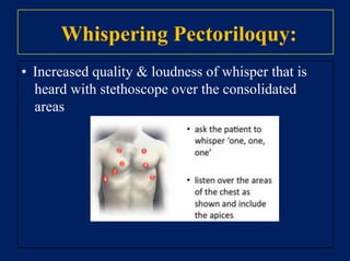 Drug history
• Relevant prescribed medication:
• Oral contraceptive pill
• Hormonal replacement therapy
• Other regular medications
• Over the counter drug
 