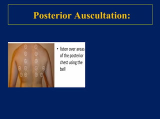 Triple assessment
1. History and Clinical examination
2. Radiological: Mammography 
or ultrasound
3. Pathology : Cyto or Histology
 