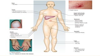 Breast abnormalities
• 1-Benign
• 2-Potentially Malignant
• 3-Premalignant
• 4-Prognostic significance
• 5-malignant
 