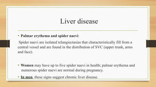 Benign Lumps
• Fibroadenoma
• Giant Fibroadenoma
• Cysts
• Benign Phylloides
• Lipomas
• Sebaceous cysts
• Granulomatous diseases
 