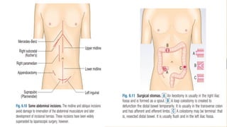Sclerosing Adenosis
• Is a proliferative lesion that is commonly found in
benign breast biopsies .
• It is a histologically complex entity that consists of
enlarged and distorted lobules, containing
duplicated and crowded acini, with prominent
myoepithelium and stromal fibrosis.
• has to be excised for full histological assessment
to avoid missing a more sinister pathology or very
close monitoring
 