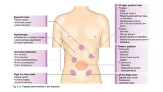 CHEST DISCOMFORT
•
Cardiovascular causes
•
Myocardial infarction
•
Angina
•
Pericarditis
•
Aortic dissection
 