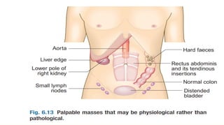 Other causes
•
Respiratory disease
•
Anaemia
•
Obesity
•
Anxiety
 