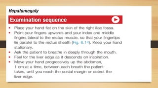 Syncope/ dizziness
•
Cardiovascular causes
•
Arrhythmias
•
Postural hypotension
•
Aortic stenosis Hypertrophic
cardiomyopathy
•
Atrial myxoma
 