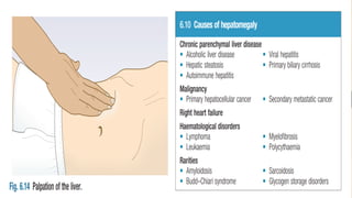 Oedema
•
Heart failure
•
Constrictive pericarditis
•
Venous stasis
•
Lymphoedema
 
