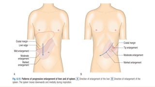 •
Terms frequently used by patients include
squeezing, tightness, pressure,
constriction, strangling, burning, heart
burn, fullness in the chest, band-like
sensation, knot in the center of the chest,
lump in throat, ache, heavy weight on
chest (elephant sitting on chest), like a bra
too tight, and toothache (when there is
radiation to the lower jaw
)
 