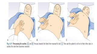 •
Thus, angina often radiates to other parts
of the body, including the upper abdomen
(epigastric), shoulders, arms (upper and
forearm), wrist, fingers, neck and throat,
lower jaw and teeth (but not upper jaw),
and rarely to the back (specifically the
interscapular region
)
 