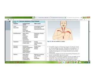 • MURMURS
• Heart murmurs are produced by
turbulent flow across an abnormal valve,
septal defect or outflow obstruction.
‘Innocent’ murmurs caused by increased
volume or velocity of flow through a
normal valve occur when stroke volume is
increased, e.g. during pregnancy, in
athletes with resting bradycardia or
children with fever
 