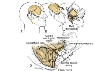 Fisch approaches Dr Zeeshan Ahmad | PPTX