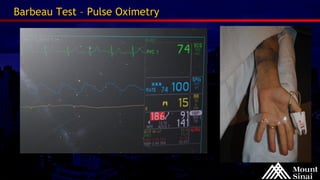 Fischman AM - AIMRADIAL 2014 Endovascular - Interventional radiology | PDF