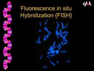 Fluorescence in situ
Hybridization {FISH}

 