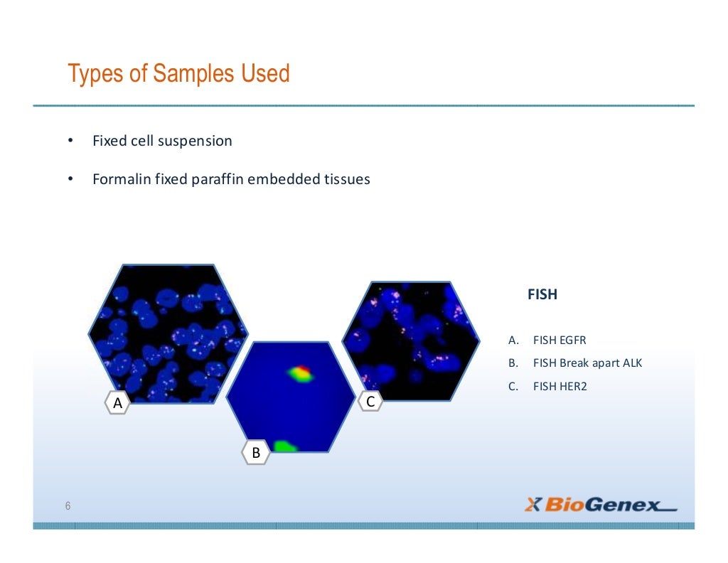 Fluorescent insitu Hybridization (FISH)