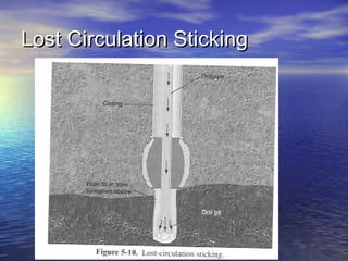 Lost Circulation StickingLost Circulation Sticking
 