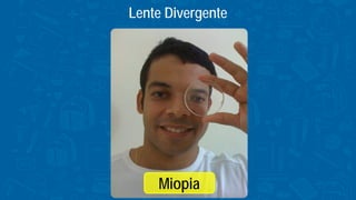 Lente Divergente
Miopia
 