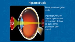 Hipermetropia
Encurtamento do globo
ocular.
O ponto próximo do
olho do hipermetrope
situa-se mais distante
do que o ponto
próximo do olho
normal.
 