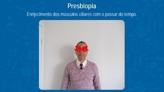 Enrijecimento dos músculos ciliares com o passar do tempo.
Presbiopia
 