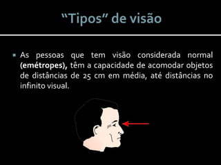  As pessoas que tem visão considerada normal
(emétropes), têm a capacidade de acomodar objetos
de distâncias de 25 cm em média, até distâncias no
infinito visual.
“Tipos” de visão
 