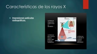 Características de los rayos X
u  Impresionan películas
radiográficas.
 