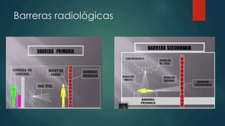 Barreras radiológicas
 
