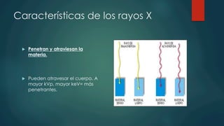 Características de los rayos X
u  Penetran y atraviesan la
materia.
u  Pueden atravesar el cuerpo. A
mayor kVp, mayor keV= más
penetrantes.
 