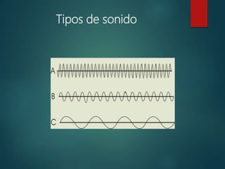 Tipos de sonido
 