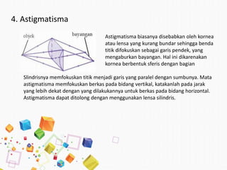 4. Astigmatisma
Astigmatisma biasanya disebabkan oleh kornea
atau lensa yang kurang bundar sehingga benda
titik difokuskan sebagai garis pendek, yang
mengaburkan bayangan. Hal ini dikarenakan
kornea berbentuk sferis dengan bagian
Slindrisnya memfokuskan titik menjadi garis yang paralel dengan sumbunya. Mata
astigmatisma memfokuskan berkas pada bidang vertikal, katakanlah pada jarak
yang lebih dekat dengan yang dilakukannya untuk berkas pada bidang horizontal.
Astigmatisma dapat ditolong dengan menggunakan lensa silindris.
 