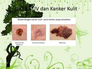 Radiasi UV dan Kanker Kulit
 