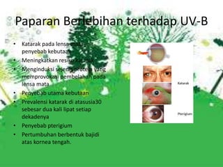 Paparan Berlebihan terhadap UV-B
• Katarak pada lensa mata
penyebab kebutaan
• Meningkatkan resiko katarak
• Menginduksi sejenis protein yang
memprovokasi pembelahan pada
lensa mata
• Penyebab utama kebutaan
• Prevalensi katarak di atasusia30
sebesar dua kali lipat setiap
dekadenya
• Penyebab pterigium
• Pertumbuhan berbentuk bajidi
atas kornea tengah.
 