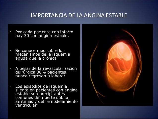 El collar para el tratamiento del cuello