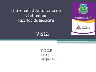 Vista
T.G.G.P
J.E.Q
Grupo: 2-8
Universidad Autónoma de
Chihuahua
Facultad de medicina
 