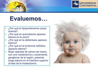 LOGO
• ¿Por qué la hipoproteinemia causa
anemia?
• ¿Por qué en quemaduras aparece
edema en la zona?
• ¿Por qué en la elefantiasis aparece
edema?
• ¿Por qué en el síndrome nefrótico
aparece edema?
• Mujer operada de cáncer de mama,
con una mastectomía y vaciamiento
ganglionar de la región, presenta
luego edema en el miembro superior
al lado de la mastectomía.
 