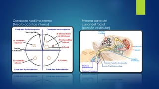 Conducto Auditivo Interno
(Meato acústico interno)
Primera parte del
canal del facial
(porción vestibular)
 