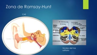 Zona de Ramsay-Hunt
CAE
Núcleo del haz
solitario
 