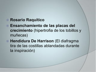  Rosario Raquítico 
 Ensanchamiento de las placas del 
crecimiento (hipertrofia de los tobillos y 
muñecas) 
 Hendidura De Harrison (El diafragma 
tira de las costillas ablandadas durante 
la inspiración) 
 