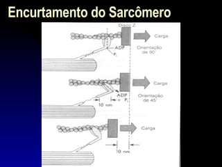 Encurtamento do Sarcômero 