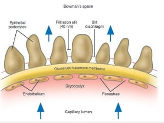 MEMBRANA DE FILTRACIÓN GLOMERULARMEMBRANA DE FILTRACIÓN GLOMERULAR
PODOCITO MEMBRANA
BASAL
ENDOTELIO
Podocito
Endotelio
fenestrado
Pedicelos
Membrana
Basal
 