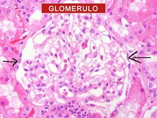 GLOMERULO
 
