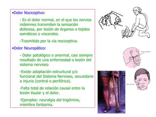 Dolor Nociceptivo: Es el dolor normal, en el que los nervios indemnes transmiten la sensación dolorosa, por lesión de órganos o tejidos somáticos o viscerales. Trasmitido por la vía nociceptiva. Dolor Neuropático: Dolor patológico o anormal, casi siempre resultado de una enfermedad o lesión del sistema nervioso Existe adaptación estructural y/o funcional del Sistema Nervioso, secundario a injuria (central o periférica). Falta total de relación causal entre la lesión tisular y el dolor. Ejemplos: neuralgia del trigémino, miembro fantasma. 