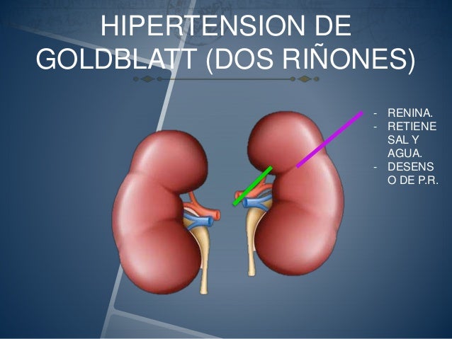 Resultado de imagen para Hipertensión de Goldblatt con dos riñones.