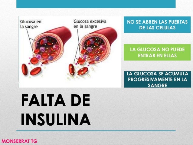Los riñones, la diabetes e insuficiencia renal por diabetes Los riñones, la diabetes e insuficiencia renal por diabetes