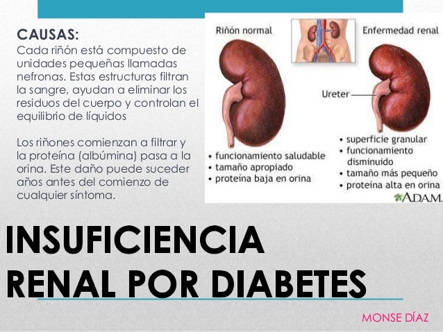 Pruebas Y Exámenes Para Los Riñones – XUKPHX