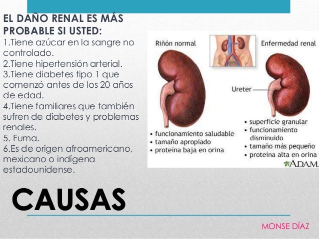 Diabetes produce picazon en el cuerpo
