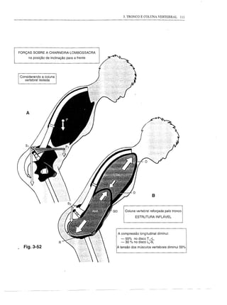 3. TRONCO E COLUNA VERTEBRAL              111




FORÇAS SOBRE A CHARNEIRA         LOMBOSSACRA
     na posição de inclinação para a frente




Considerando a coluna
   vertebral isolada




   A




                                                                       8

                                                    Coluna vertebral reforçada pelo tronco
                                                           ESTRUTURAINFLÁVEL




                                               A compressão   longitudinal diminui:
                                                  - 50% no disco T'2 -L,
                                                  - 30 % no disco LsS,
  Fig.3-52                                     A tensão dos músculos vertebrais diminui 55%
 